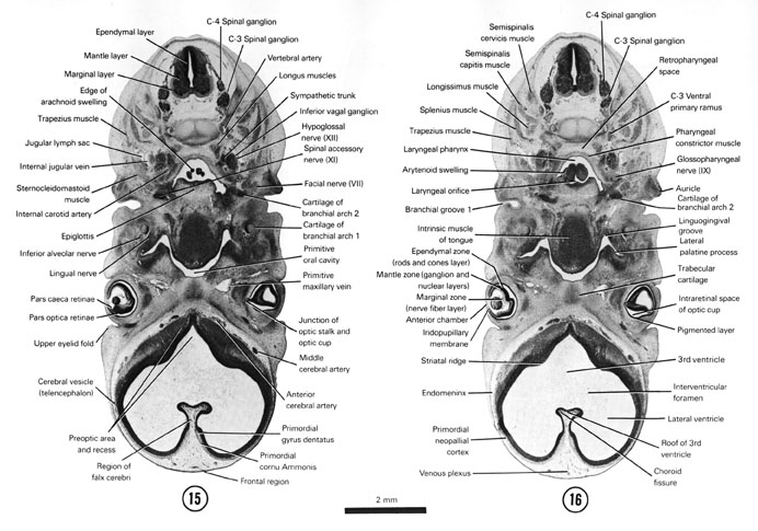 Open PDF version of FIG 7-13, A section through the C-4 spinal ganglion and the preoptic area of the telencephalon. A section through the middle of the optic cup and laryngeal orifice.