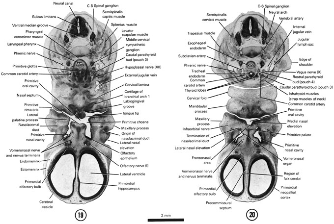 Open PDF version of FIG 7-15, A section through the C-5 spinal ganglion and primitive choana. A section through the C-6 spinal ganglion and the primitive palate.