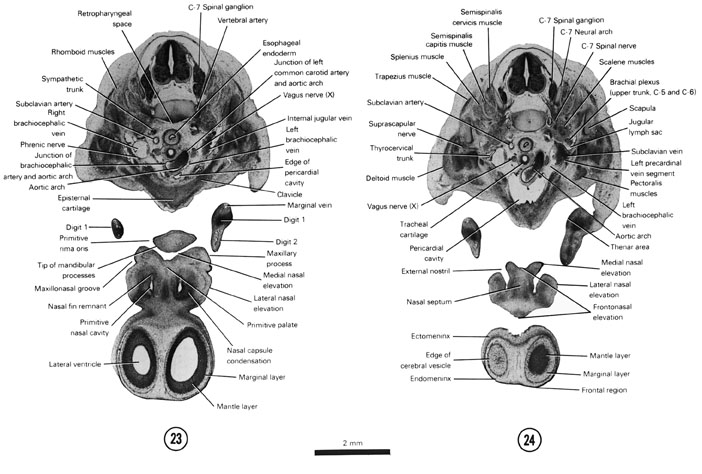 Open PDF version of FIG 7-17, A section through the aortic arch and the tip of the mandibular process. A section through the external nostril and cranial part of the pericardial cavity.