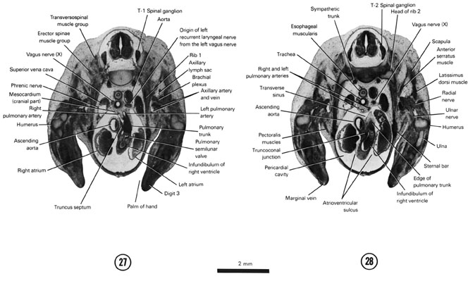 Open PDF version of FIG 7-19, A section through the pulmonary semilunar valve. A section through the T-2 spinal ganglion.