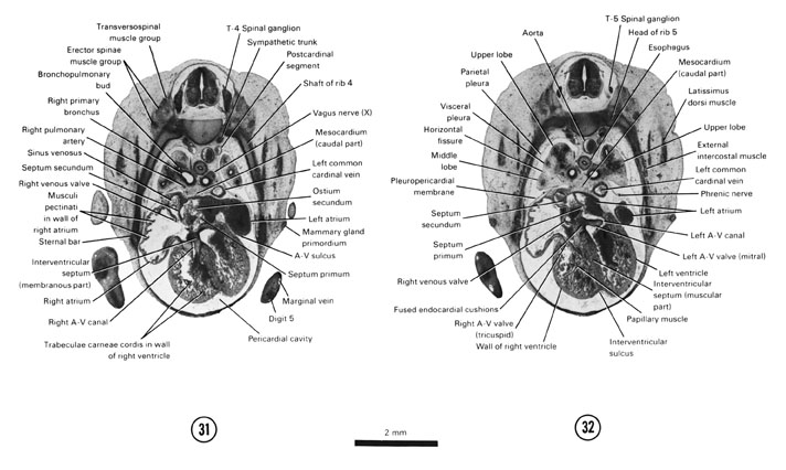 Open PDF version of FIG 7-21, A section through the T-4 spinal ganglion and the right atrioventricular (A-V) canal. A section through the T-5 spinal ganglion and the right and left atrioventricular valves.