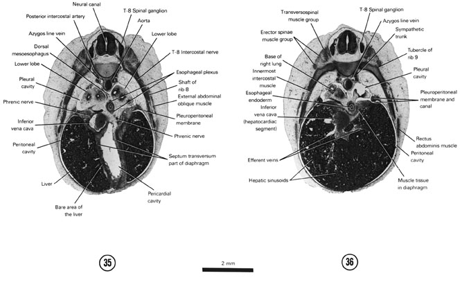 Open PDF version of FIG 7-23, A section through the T-8 spinal ganglion and caudal part of the pericardial cavity. A section through the pleuroperitoneal canal and base of the lungs.