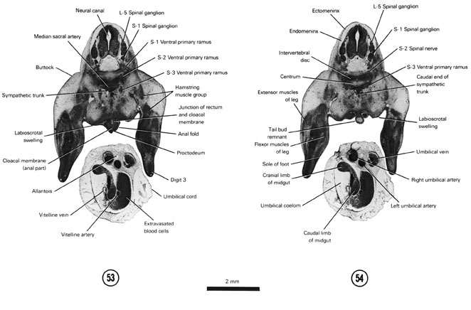 Open PDF version of FIG 7-32, A section through the S-1 spinal ganglion. A section through the tip of the tail bud remnant. 