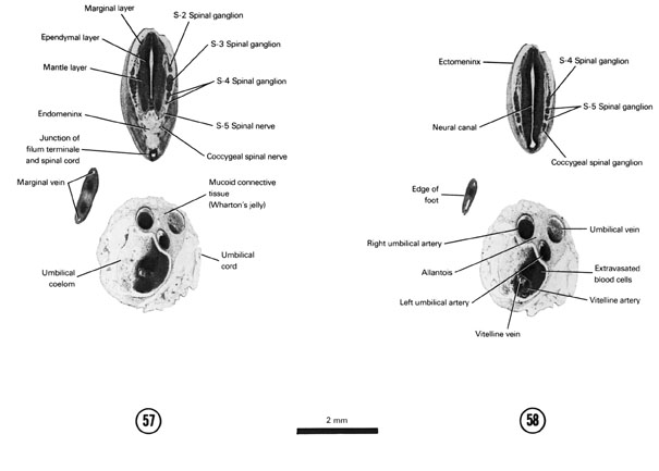 Open PDF version of FIG 7-34, A section through the S-3 and S-4 spinal ganglia. A section through the S-5 and coccygeal spinal ganglia.