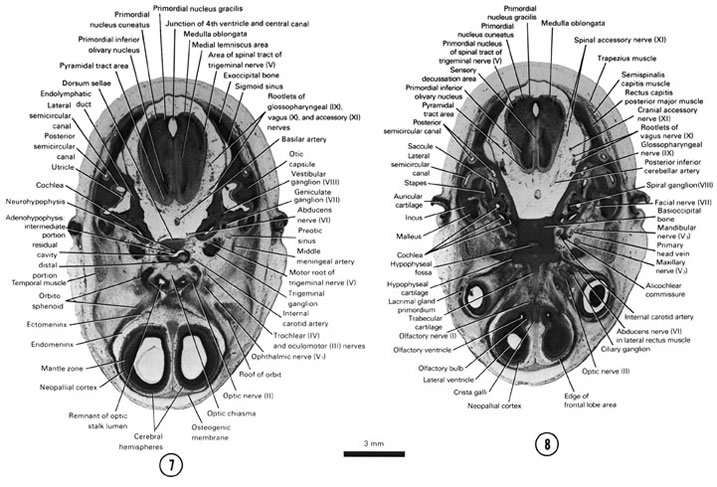 Open PDF version of FIG 8-6, A section through the cerebral hemispheres, optic nerve, optic chiasma and medulla oblongata. A section through the edge of the cerebral hemispheres (frontal lobe area) and medulla oblongata.