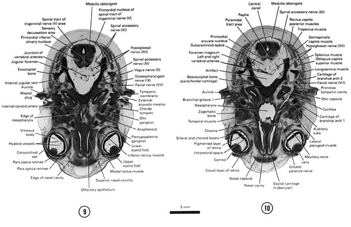 Open PDF version of FIG 8-7, A section through the medulla oblongata and the cranial edge of the nasal cavity and nasopharynx. A section through the middle of the eye and caudal part of the medulla oblongata. 