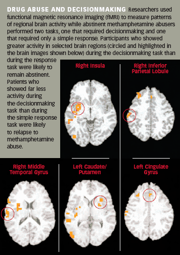 Drug abuse and decision making, functional magnetic resonance imaging, brain scan, fMRI, brain