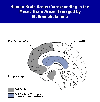 Human Brain Areas Corresponding to the Mouse Brain Areas Damaged by Methamphetamine.