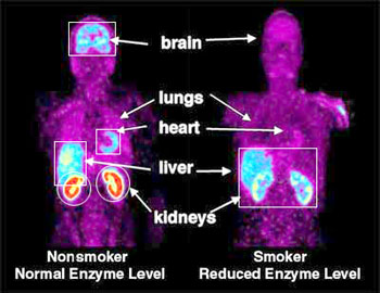 PET Scan smoker vs nonsmoker