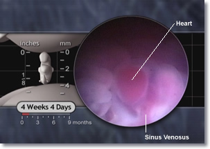 sinus venosus, sinoatrial node, embryo heart, embryonic