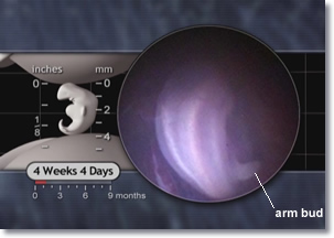 4 week 4 days embryo, arm bud