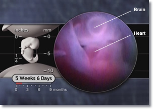 Brain and heart of a 5 week 6 day embyro.