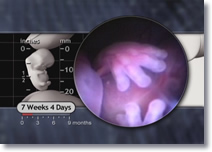 Fingers of the 7 weeks 4 days embryo.