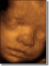 Fetus 25 Weeks 3D Ultrasound