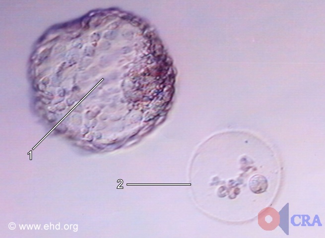 Hatched Blastocyst [Click for next image]