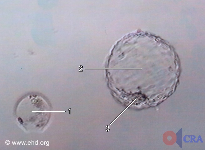 Hatched Blastocyst [Click for next image]