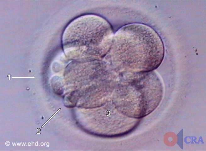 Seven-Cell Embryo [Click for next image]