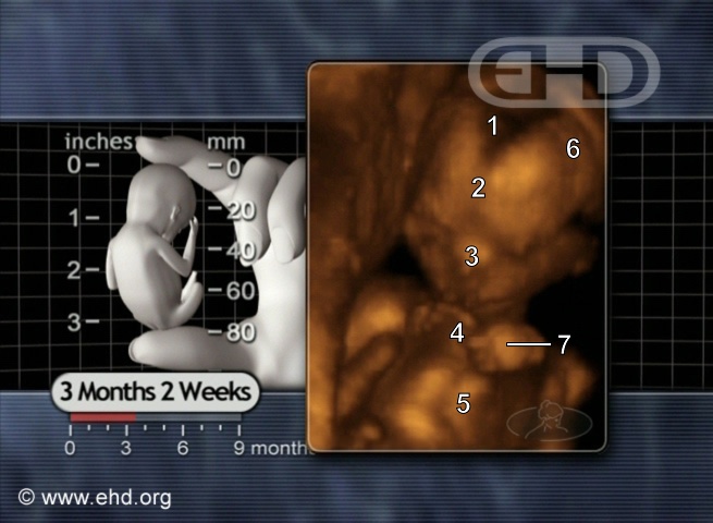 The 14-Week Fetus [Click for next image]