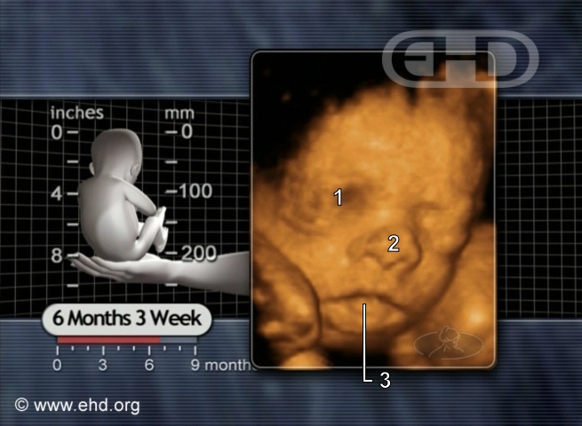 The Face at 27 Weeks [Click for next image]