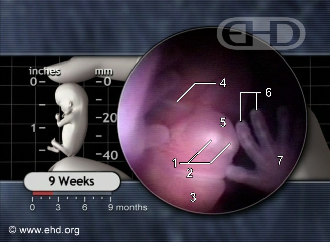 The Face at 9 Weeks