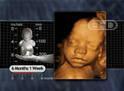 Fetal Respiratory Rate