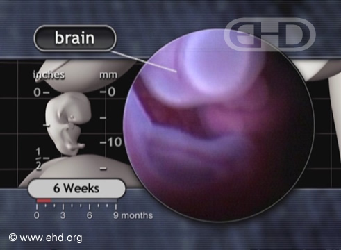 Brain and Umbilical Cord