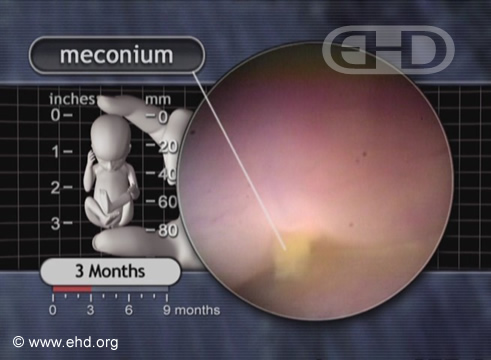 Meconium Release