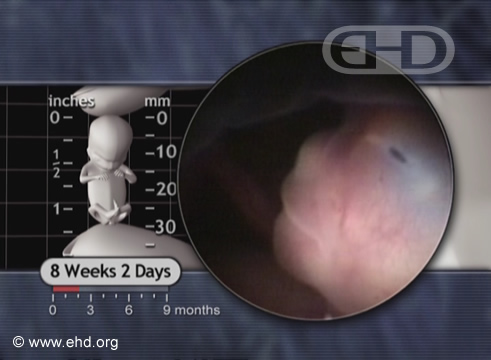 Nose, Eight Weeks Pregnant