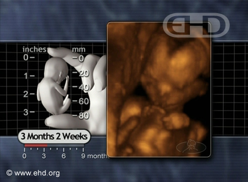 The 14-Week Fetus