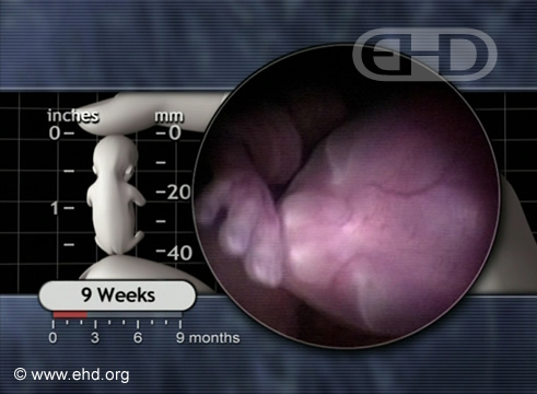 The 9-Week Fetus
