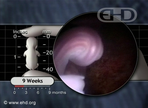 The 9-Week Umbilical Cord
