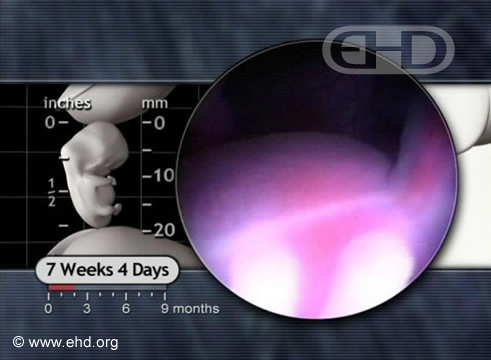 The Abdomen and Umbilical Vein