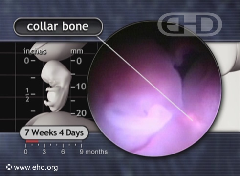 The Collar Bone and Ear