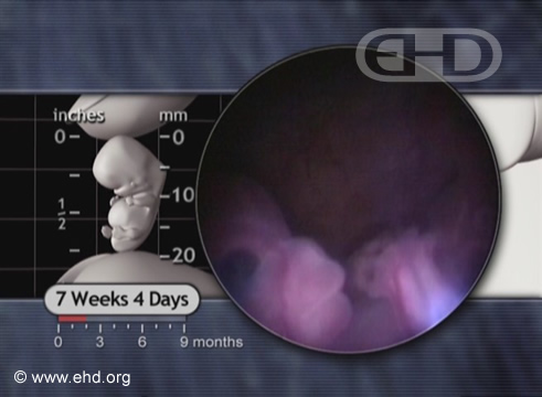 The Seven-Week Face