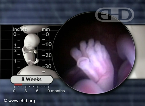 The Toes Face Off