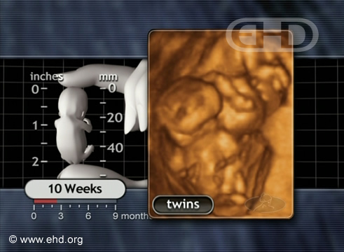 Twins at Play