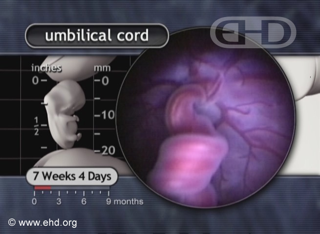 Close-up of Umbilical Cord [Click for next image]