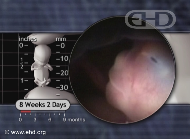 Nose, Eight Weeks Pregnant [Click for next image]