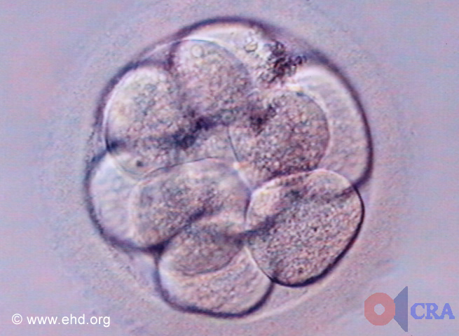 Ten-Cell Embryo [Click for next image]