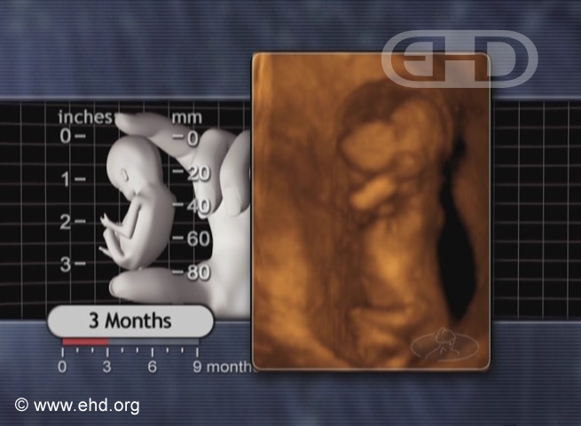 Three-Month Fetus [Click for next image]